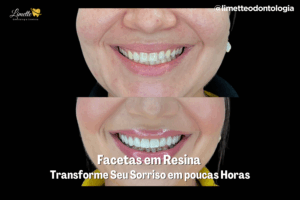 Capas Blog PNCG 900x600 2