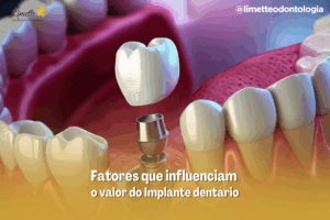 Capas Blog PNCG 900x600 6
