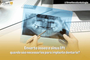 Capas Blog PNCG 900x600 8