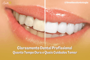 Quanto tempo dura o clareamento dental profissional?