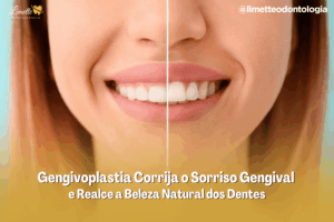 Gengivoplastia em Campo Grande – Corrija o Sorriso Gengival e Realce a Beleza Natural dos Dentes