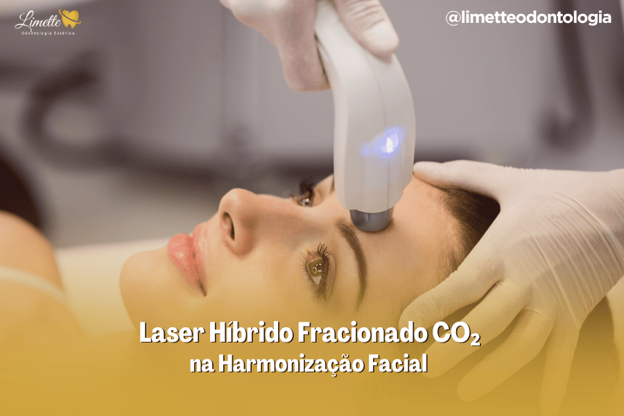 Laser Híbrido Fracionado CO₂ na Harmonização Facial