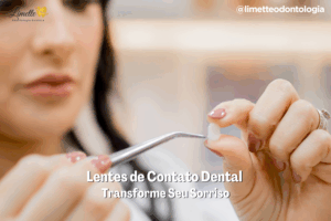 Lentes de Contato Dental em Campo Grande – Transforme Seu Sorriso