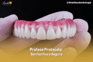 Protese Protocolo Campo Grande MS
