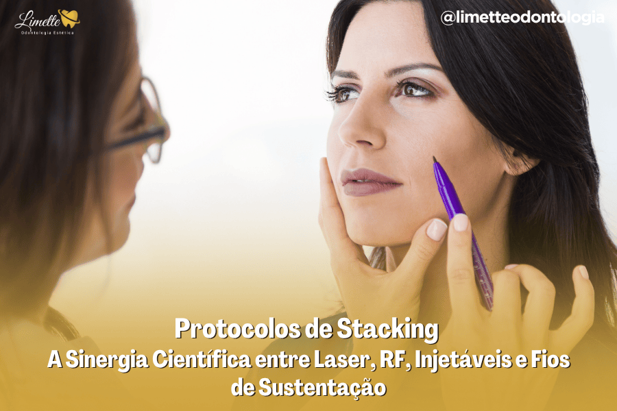 Protocolos de Stacking na Harmonização Facial – A Sinergia Científica entre Laser, RF, Injetáveis e Fios de Sustentação