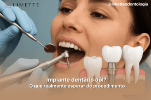 Implante dentário dói O que realmente esperar do procedimento