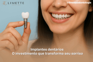 Implantes dentários em Campo Grande