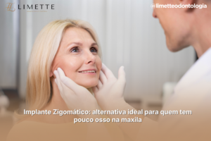 Implante Zigomático