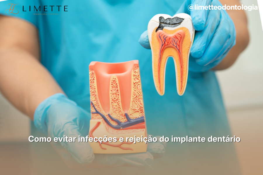 Capas Blog PNCG 900x600 7