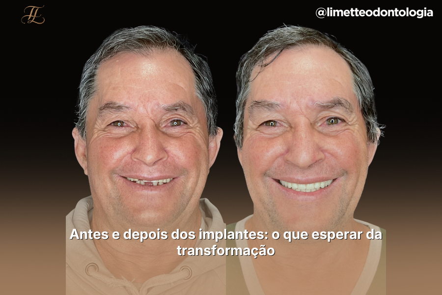 Capas Blog PNCG 900x600 9