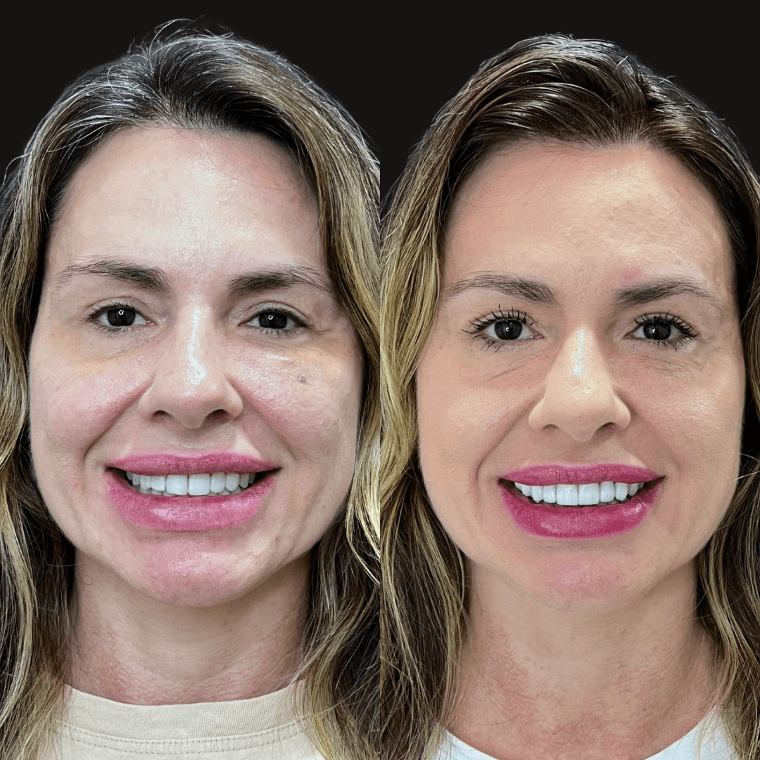 4 1