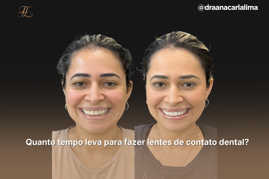 Quanto tempo leva para fazer lentes de contato dental? 2 Capas Blog PNCG 900x600 22