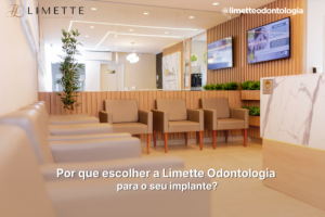 Por que escolher a Limette Odontologia para o seu implante?