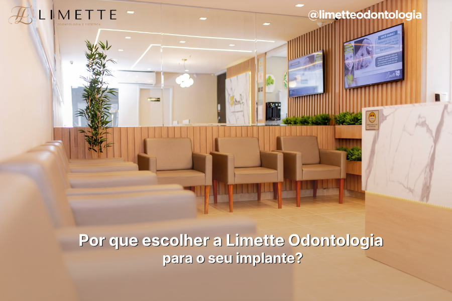 Por que escolher a Limette Odontologia para o seu implante?