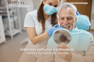 Implantes dentários e autoestima: como o sorriso muda sua vida