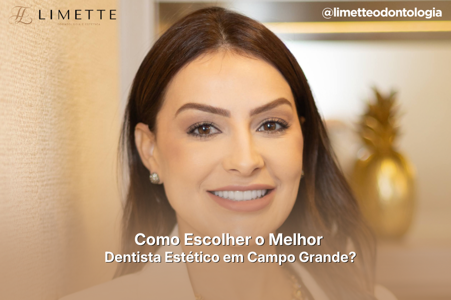 Como Escolher o Melhor Dentista Estético em Campo Grande?