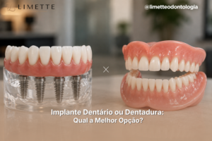 Implante Dentário ou Dentadura: Qual a Melhor Opção?