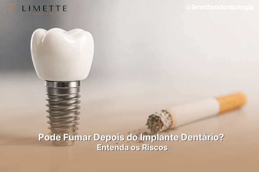 Pode Fumar Depois do Implante Dentário? Entenda os Riscos