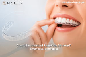 Aparelho Invisível Funciona Mesmo? Entenda a Tecnologia