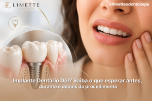 Implante Dentário Dói? Saiba o que esperar antes, durante e depois do procedimento