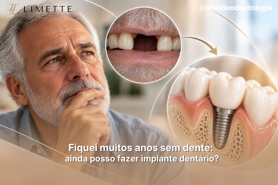 Fiquei muitos anos sem dente: ainda posso fazer implante dentário?