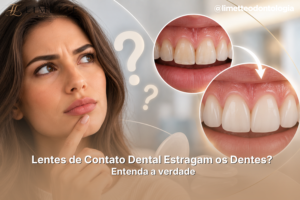Lentes de Contato Dental Estragam os Dentes? Entenda a verdade