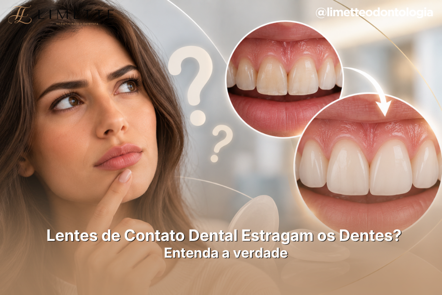 Lentes de Contato Dental Estragam os Dentes? Entenda a verdade