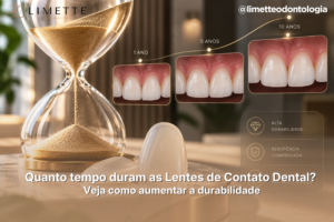 Quanto tempo duram as Lentes de Contato Dental? Veja como aumentar a durabilidade