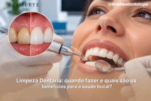 Limpeza Dentária: quando fazer e quais são os benefícios para a saúde bucal?