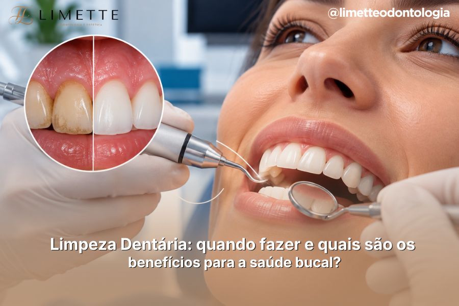 Limpeza Dentária: quando fazer e quais são os benefícios para a saúde bucal?