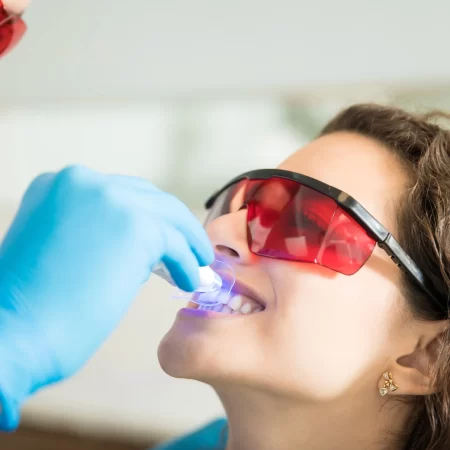 closeup-de-jovem-tendo-seus-dentes-clareados-com-luz-ultravioleta-em-uma-clinica-odontologica