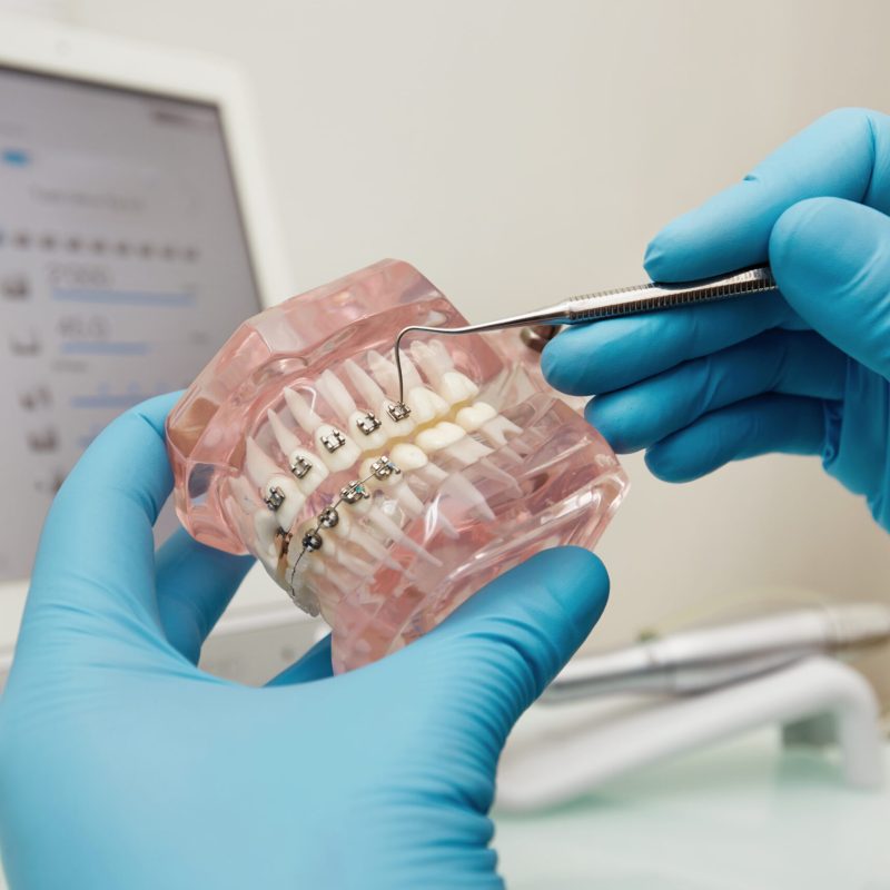 Prosthetics hands while working on the denture, false teeth, a study and a table with dental tools. Dental laboratory.