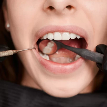 fotografia-macro-de-um-belo-sorriso-feminino-com-dentes-brancos-e-saudaveis