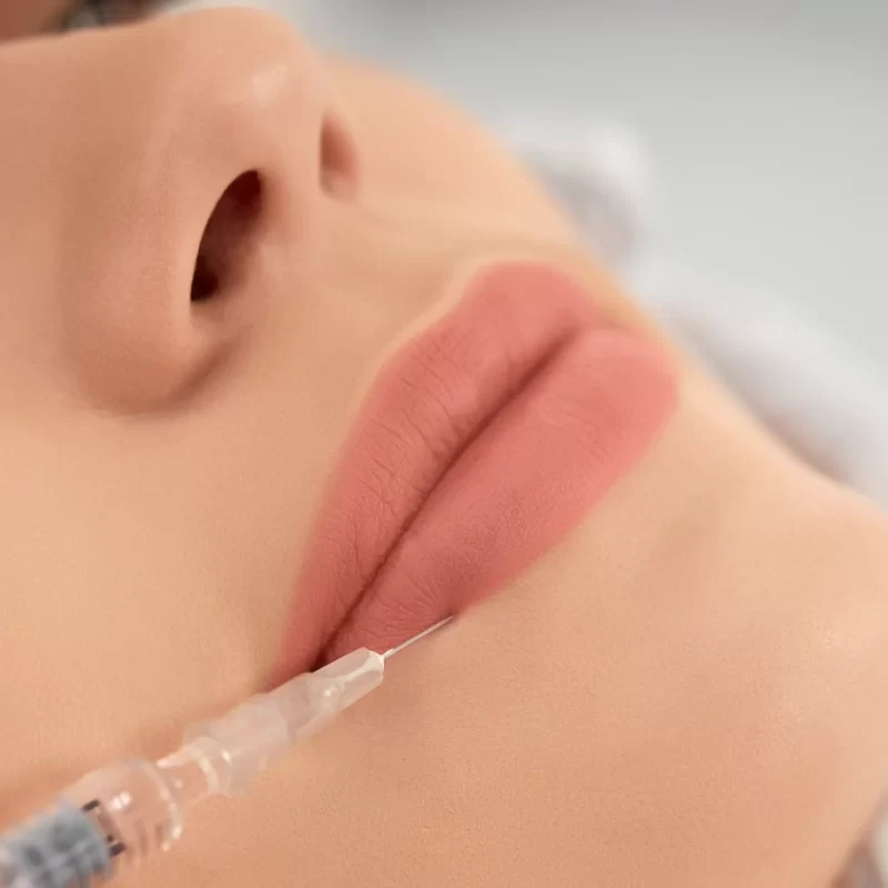 procedimento-de-aumento-labial-em-salao-profissional_3_11zon